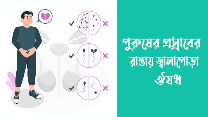 পুরুষের প্রস্রাবের রাস্তায় জ্বালাপোড়া ঔষধ