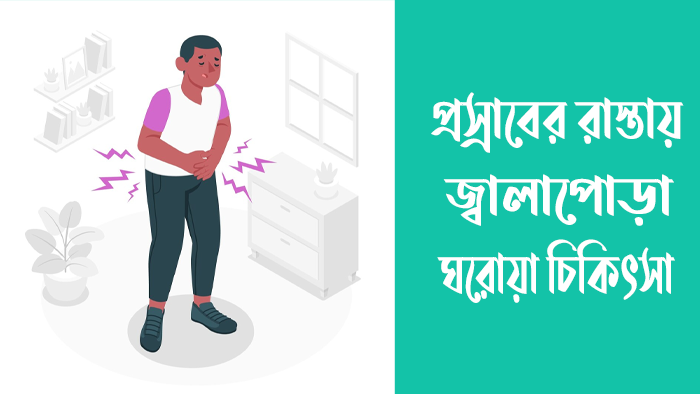 প্রস্রাবের রাস্তায় জ্বালাপোড়া ঘরোয়া চিকিৎসা